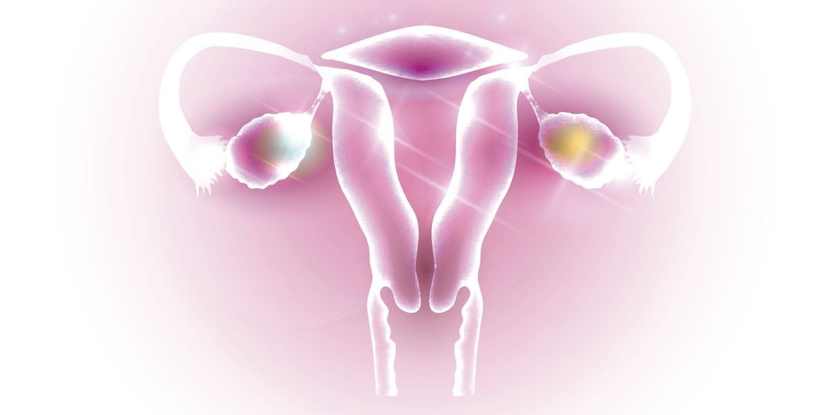 Everything you need to know about PCOS