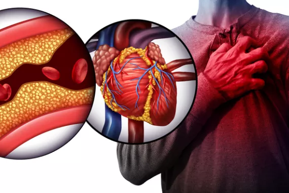 Causes of cardiac diseases and their treatments