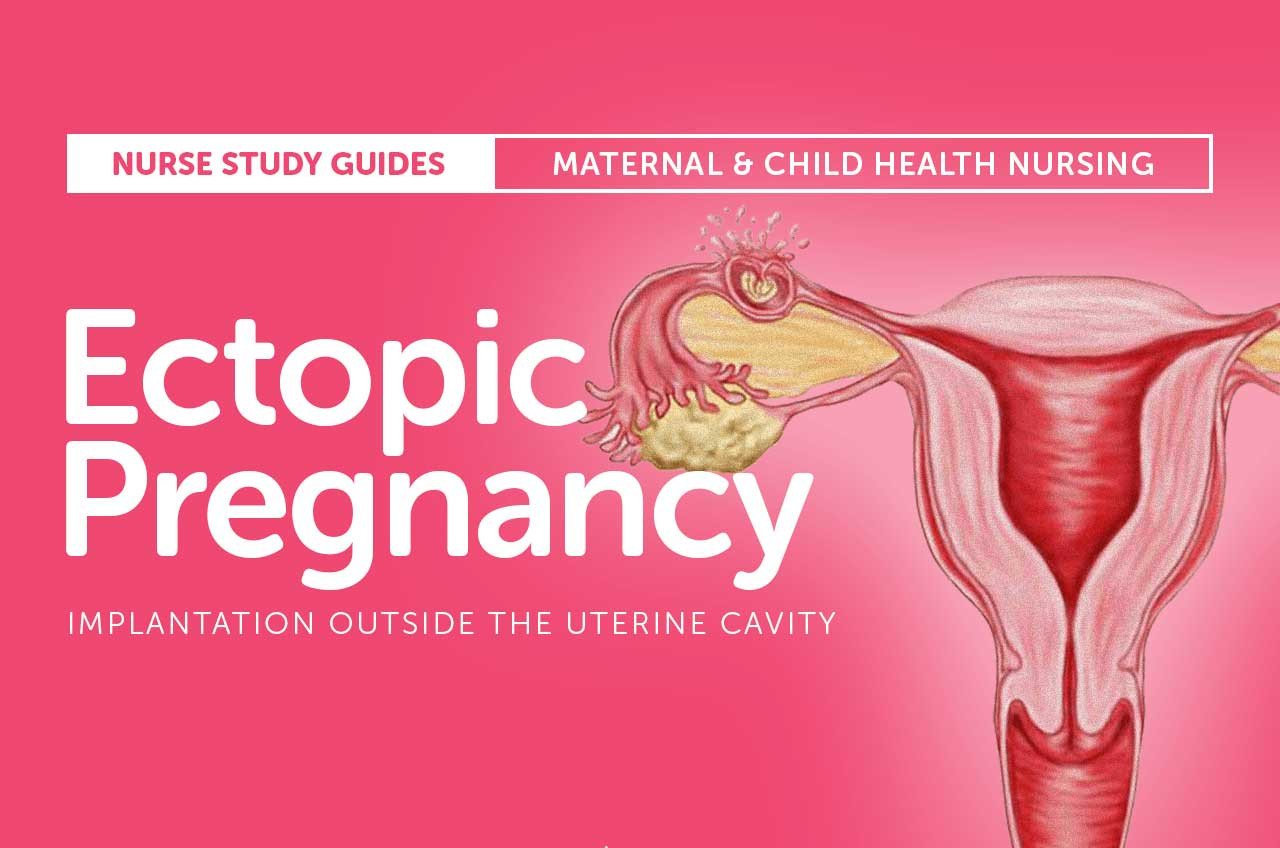 Finding the Cause of Ectopic Pregnancy and their Treatment Options with Ace Medicare