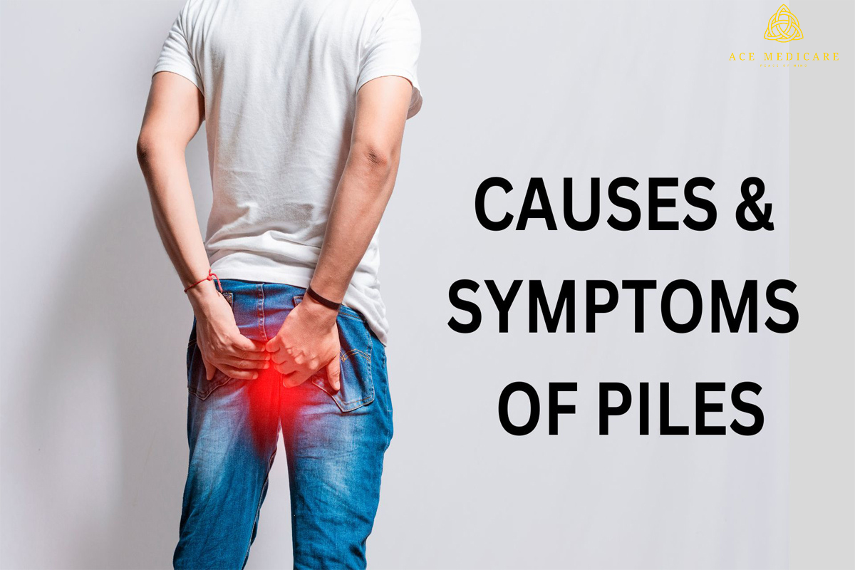 The Ultimate Guide to Understanding Piles: Symptoms, Causes, and Treatment Options