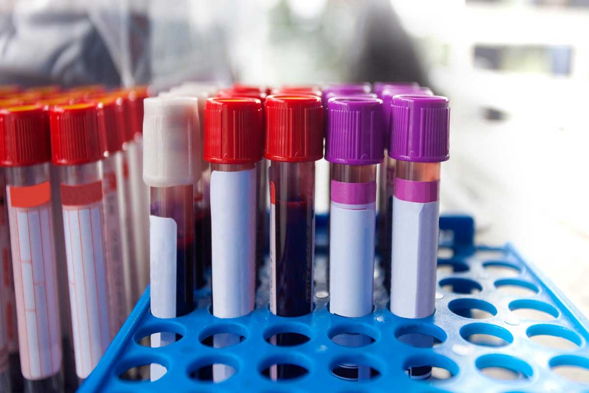 Ace Medicare Introduces Cutting Edge Blood Test Lab for Better Health Monitoring
