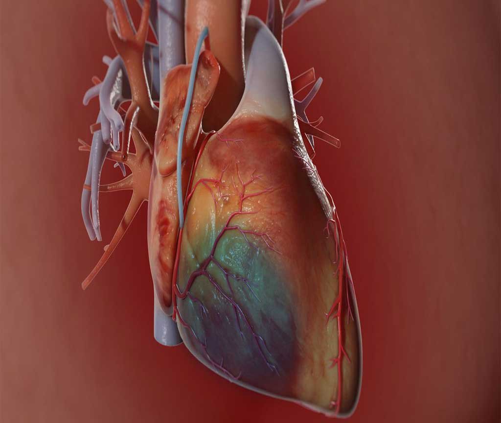 Coronary Artery Bypass Surgery – A Boon to Medical Science!