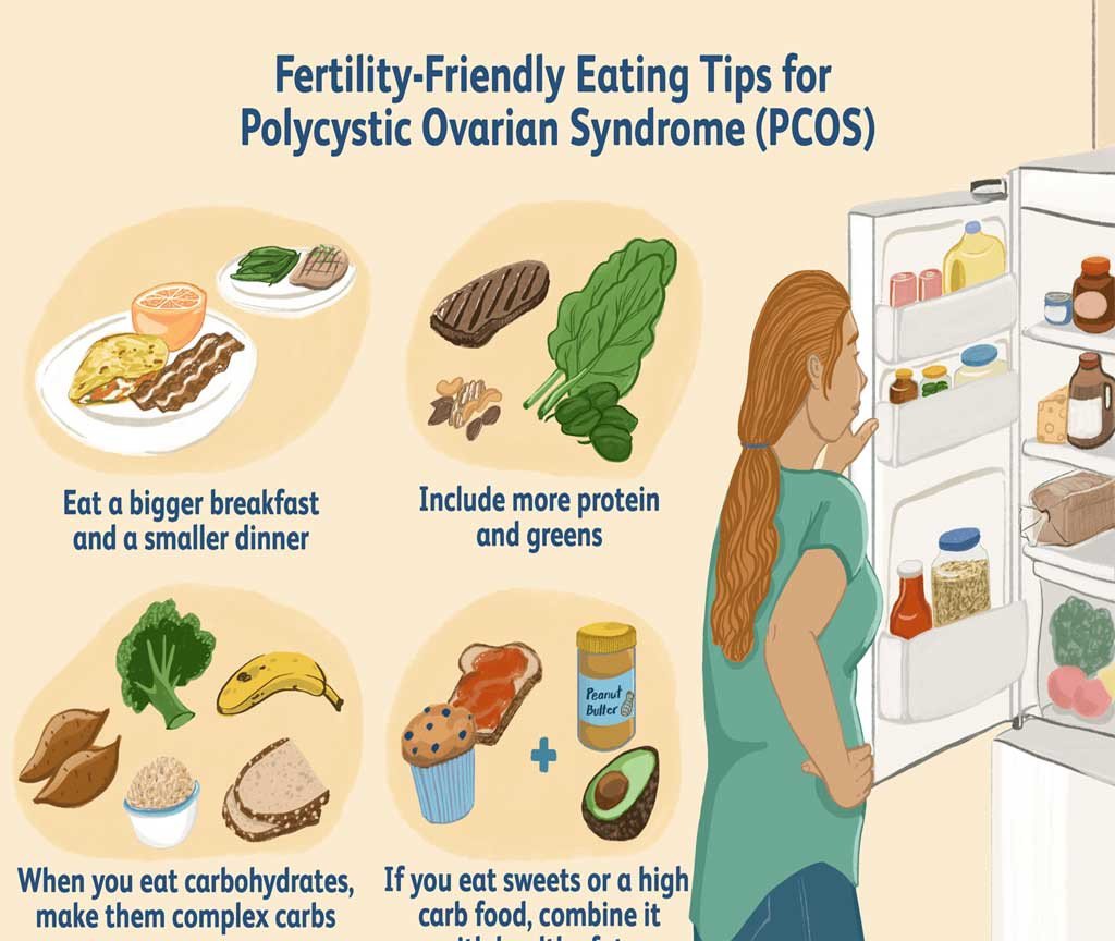 How Diet & Physical Activity Helps with PCOS Symptoms