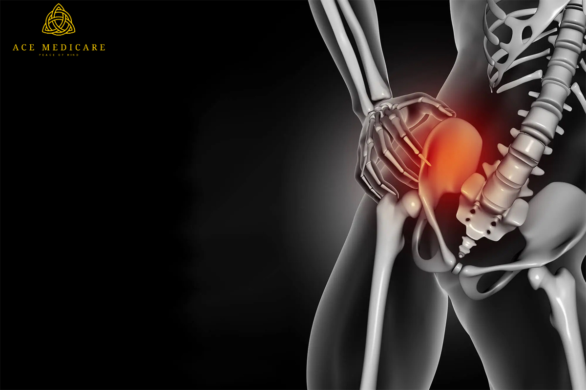 The Ultimate Guide to Hip Replacement Surgery: What You Need to Know